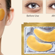 Similar to the gel eye mask, these under-eye patches help get rid of that tired look that my face develops after a migraine.